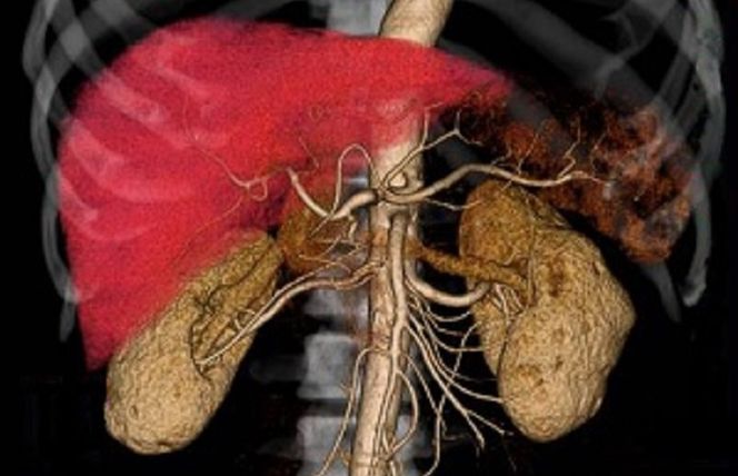 099H025 IGTクリニック 特殊がん検診 マイクロアレイ【がん専門 クリニック 泉佐野市 りんくう】