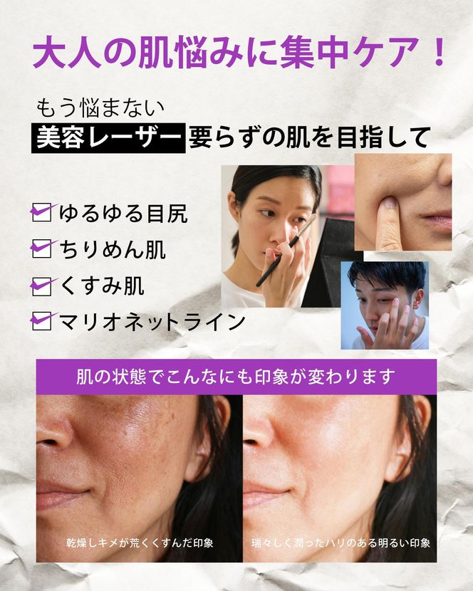 【MARK AID】エクソスピキュールクリーム 3個セット【エクソソーム針クリーム】［ 京都 美容 ブランド スキンケア 化粧品 美容液 クリーム エイジングケア 人気 おすすめ しわ くすみ お取り寄せ 通販 送料無料 ふるさと納税 ］ 261009_B-UA07