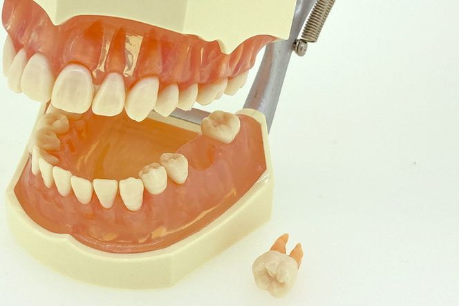 歯の模型 歯磨き指導用 実物大モデル（歯着脱可）《歯 模型 歯列模型 歯模型 顎模型 歯医者使用 教材》 ※着日指定不可