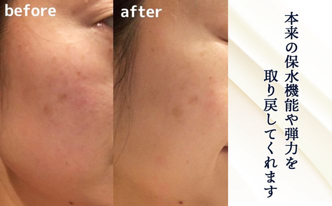 北海道白老産 生プラセンタ美容液 ～アヨロのピリカ～ AN002 