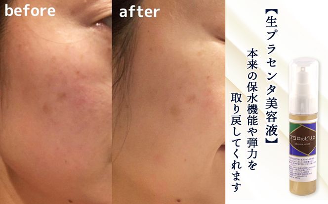 北海道白老産 生プラセンタ美容液＆サプリメント(北海道産) ～アヨロのピリカ・アンケシ～ AN004 