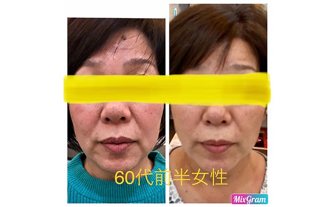小顔矯正コルギチケット×10回 体験チケット 美容 