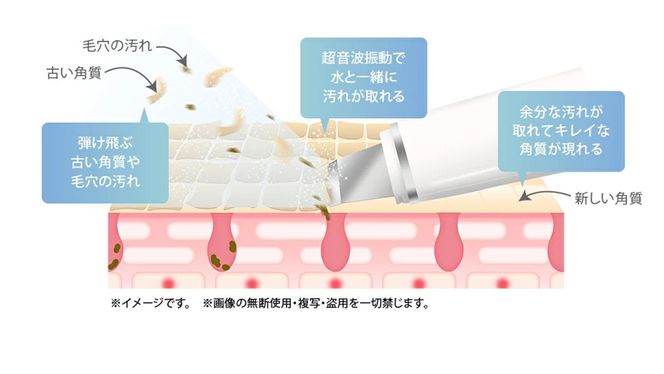 ＼選べるカラー・ラッピング対応／美ルル アクアルファクラシック（ウォーターピーリング美顔器）ホワイト ピンク 超音波 ウォーターピーリング 美顔器 イオン導出 イオン導入 保湿 リフトアップ エイジングケア 毛穴ケア 美肌 belulu New AquaRufa classic ギフト プレゼント [DD76-NT00]