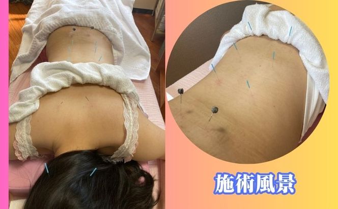 平針北クリニック 鍼灸マッサージ 1回券 予約制 女性専用 