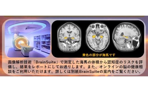 【贈り物にも】トワイライトドック～夕方からの脳の健康診断～