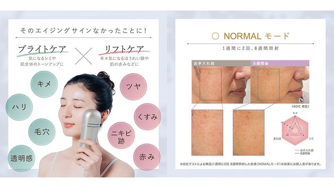 LINKA スノー フラッシュ（DPL_NIR 光美容器） LINKA リンカ 美顔器 美白 美容 スキンケア 美容家電 エステ フォトフェイシャル [EV07-NT]