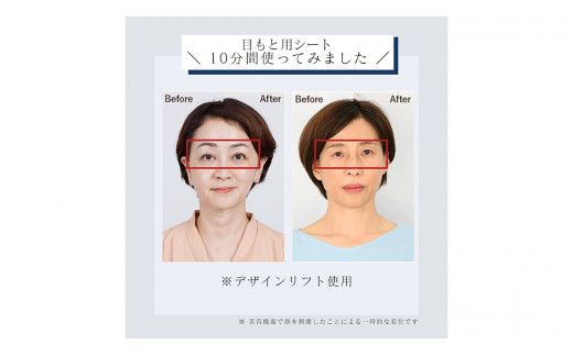 デザインリフト モア 目元/口元ケアセット （ 本体 ＆ 目元用ストレッチフィットシート1セット ＆ 口元用ストレッチフィットシート1セット ) ヤーマン YA-MAN ya-man 美顔器 美容家電 リフトアップ リフトケア ハンズフリー EMS プレゼント クリスマス ほうれい線  [EX002us]