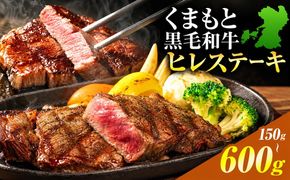 くまもと黒毛和牛 ヒレステーキ 選べる内容量 150g 300g 450g 600g 牛肉 冷凍 《7-14日以内に出荷予定(土日祝除く)》 くまもと黒毛和牛 黒毛和牛 冷凍庫 個別 取分け 小分け 個包装 ステーキ肉 にも ヒレステーキ---oz_lcl_950_150g---