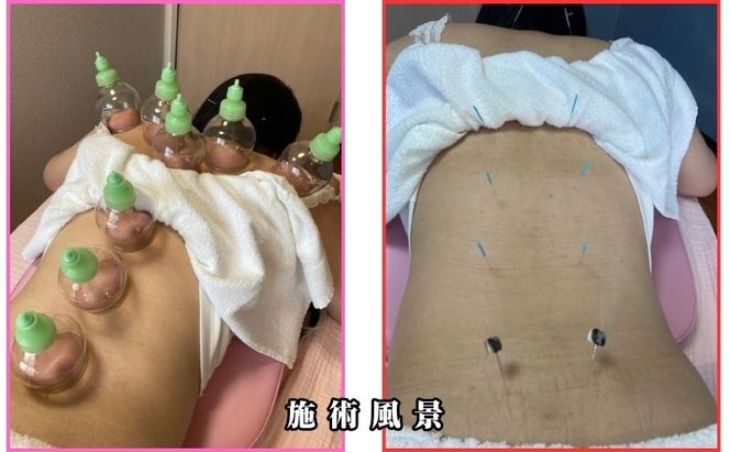 平針北クリニック 鍼灸マッサージ 1回券 予約制 女性専用 