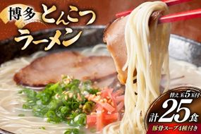 博多 とんこつ ラーメン 20人前と替え玉5玉 計25食 スープ 4種類 付き [炭焼豚丼と塩ホルモンの店 西北の杜 福岡県 宇美町 um40bfw560007] とんこつ 豚骨 豚骨ラーメン とんこつラーメン らーめん スープ
